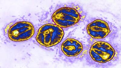  کاربرد مهندسی بافت در پیوند استخوان/ موثر بودن مهندسی بافت و فناوری‌های نوظهور در درمان دندان پزشکی