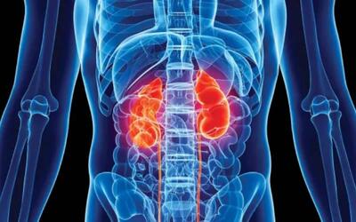  علائم هشدار دهنده بیماری های کلیه؛ روش های پیشگیری و درمان