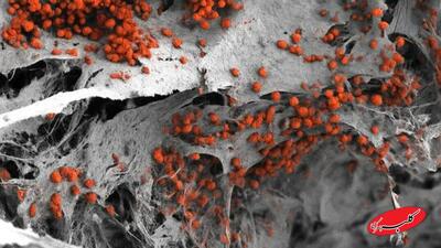  فناوری به کمک درمان سرطان خون آمد | ساخت نخستین نمونه انسانی «مغز استخوان» در آزمایشگاه - کلبه سرگرمی