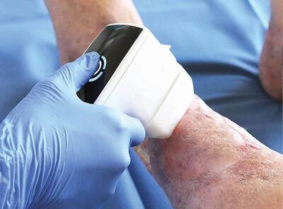  تاریخچه و روند توسعه فناوری پلاسما در پزشکی