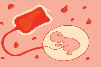  فرصت ها و چالش های ذخیره خون بندناف در  پزشکی نوین | بیمه حیات پشت دیوار بی‌پولی