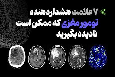  اینفوگرافیک/ ۷ علامت هشداردهنده تومور مغزی که ممکن است نادیده بگیرید
