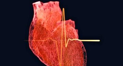  خطر بیماری قلبی در مردان از ۳۵ سالگی آغاز می‌شود