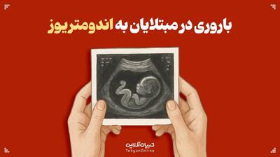  باروری در مبتلایان به اندومتریوز