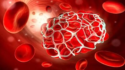   بیماران هموفیلی، همچنان منتظر باشند/ کمبودهای دارویی سراسری است 