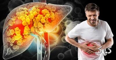  ۶ راهکار مهم برای پاکسازی کبد | مواد غذایی مؤثر در پاکسازی کبد را بشناسید - مجله اینترنتی کولاک