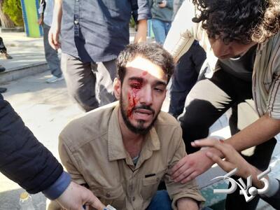  تجمعات امروز دانشگاه تهران به خشونت کشیده شد +عکس - مجله اینترنتی کولاک